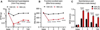 The degeneration-pain relationship in the temporomandibular joint: Current understandings and rodent models